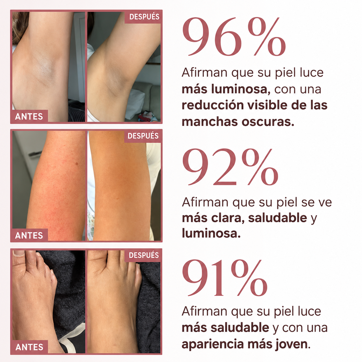Spray Exfoliante Aclarante con Ácido Kójico