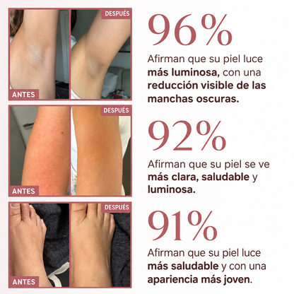 Spray Exfoliante Aclarante con Ácido Kójico